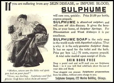 Sulphume skin disease remedy advertisement with mother and child