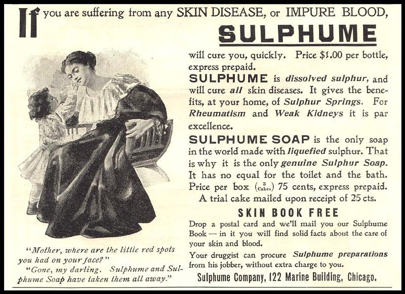 Sulphume skin disease remedy advertisement with mother and child — historic image
