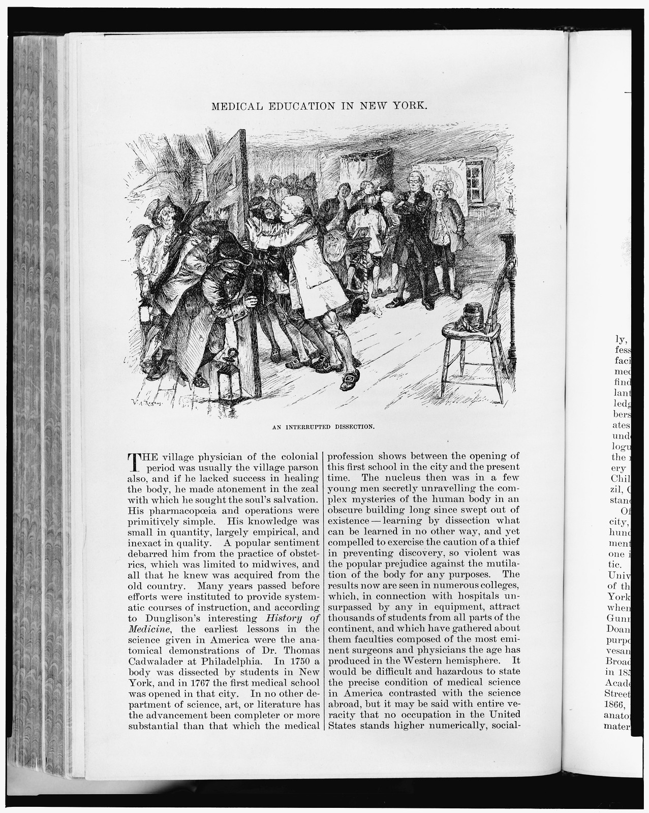 An Interrupted dissection / W.A. Rogers., [published in 1882] — antique engraving