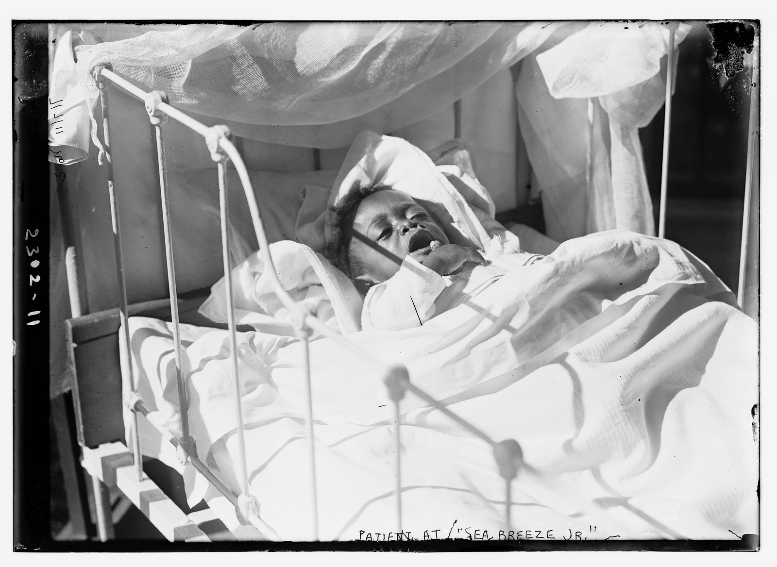 Patient at "Sea Breeze Jr.", n/a — historic photograph