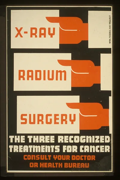 X-Ray radium surgery - the three recognized treatments for cancer Consult your doctor