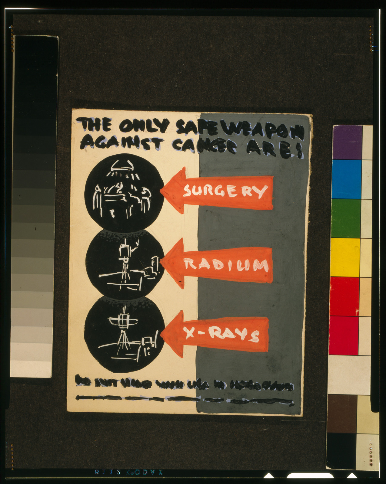 The only safe weapons against cancer are: surgery, radium, x-rays, [1937] — historic image