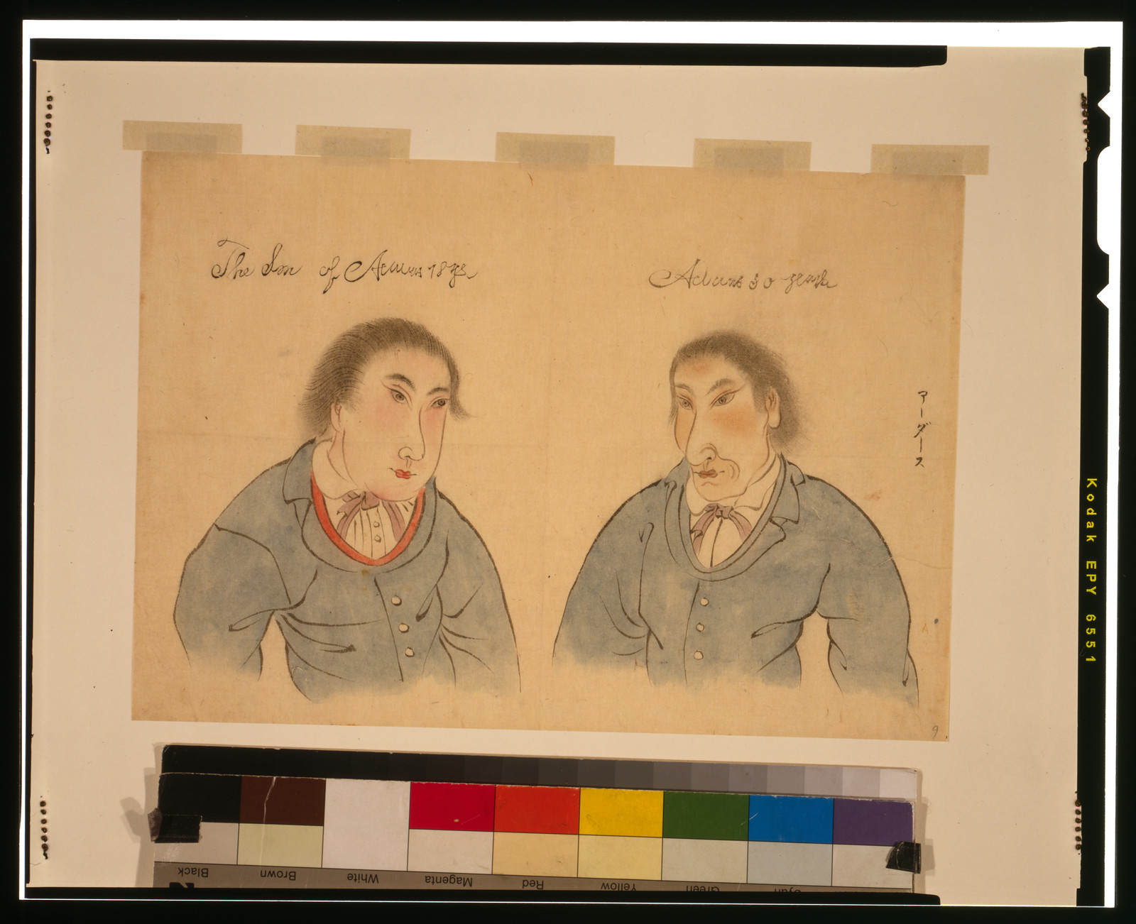 The son of A[...] 18 yrs -- A[...] 50 years, [between 1850 and 1900] — historic print