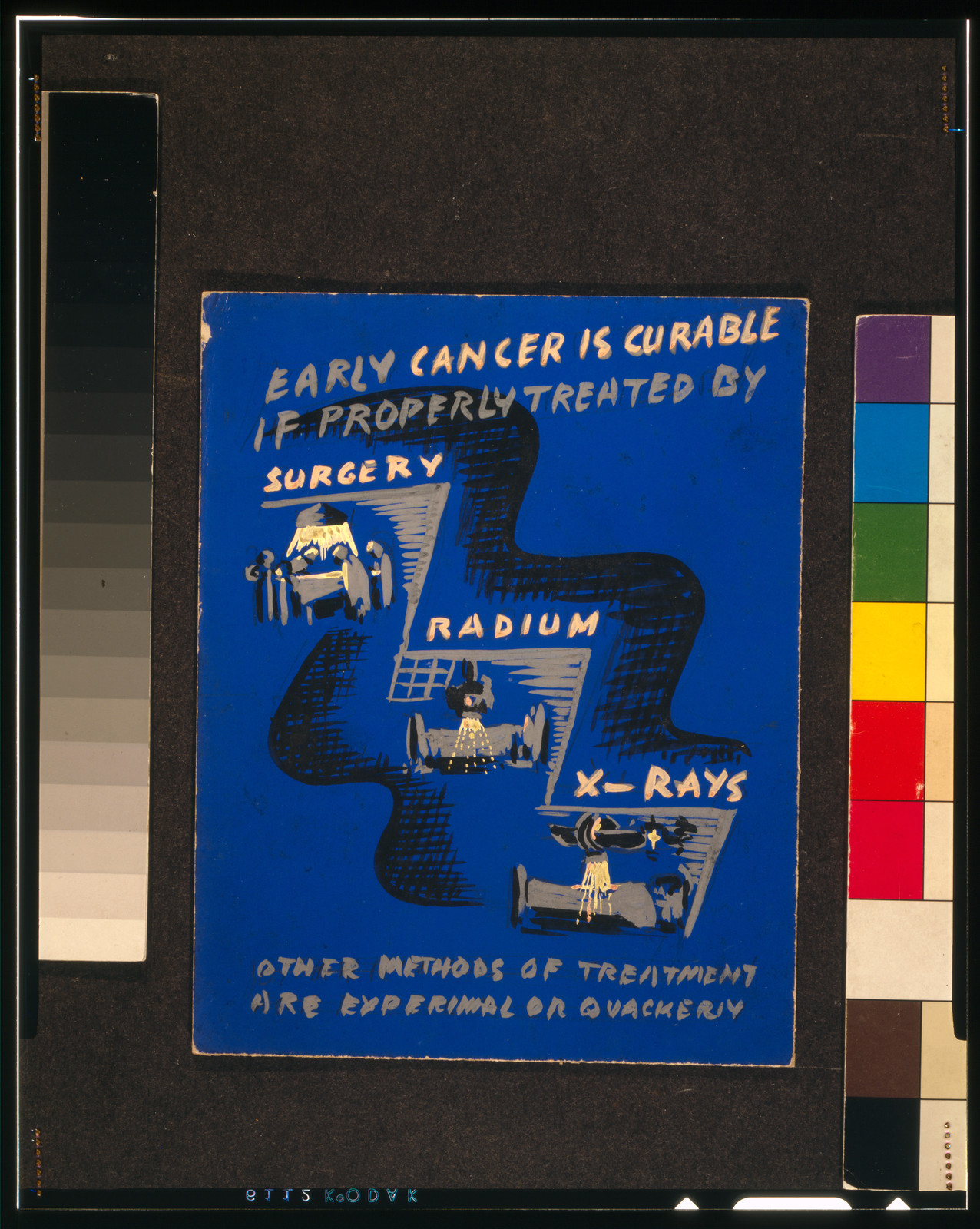 Early cancer is curable if properly treated by surgery, radium, x-rays Other methods of treatment are experimental or quackery., [1937] — historic image