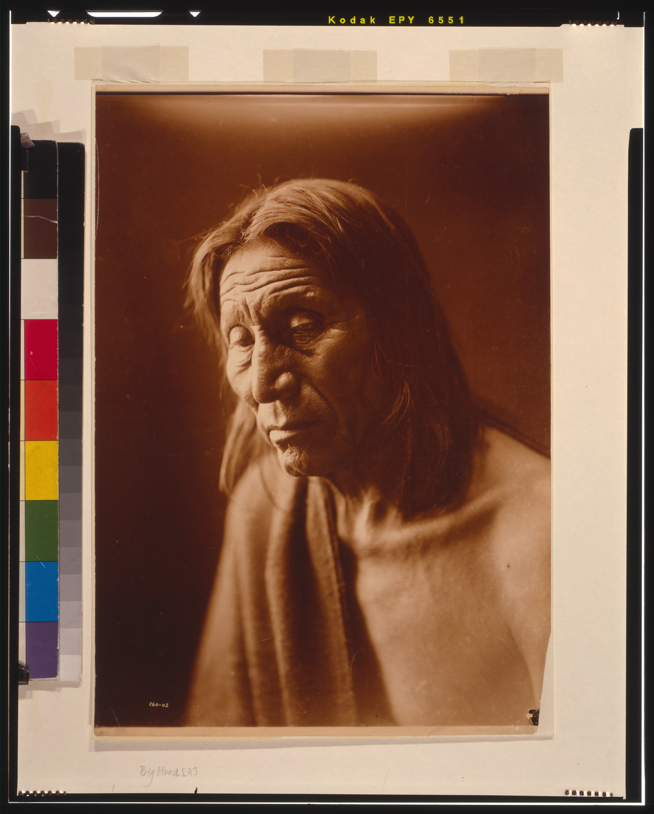Big Head [A], c1905. — historic photograph