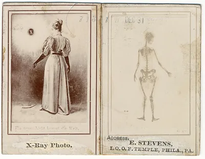 XRayphoto