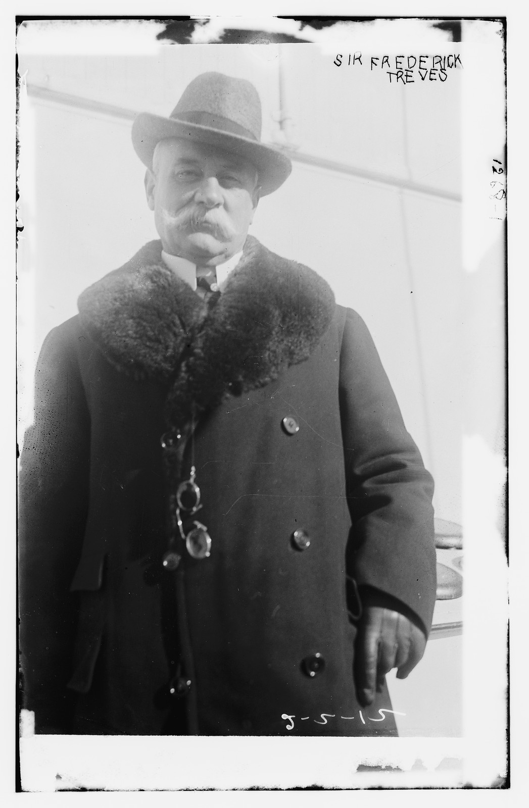 Sir Frederick Treves, n/a — historic photograph