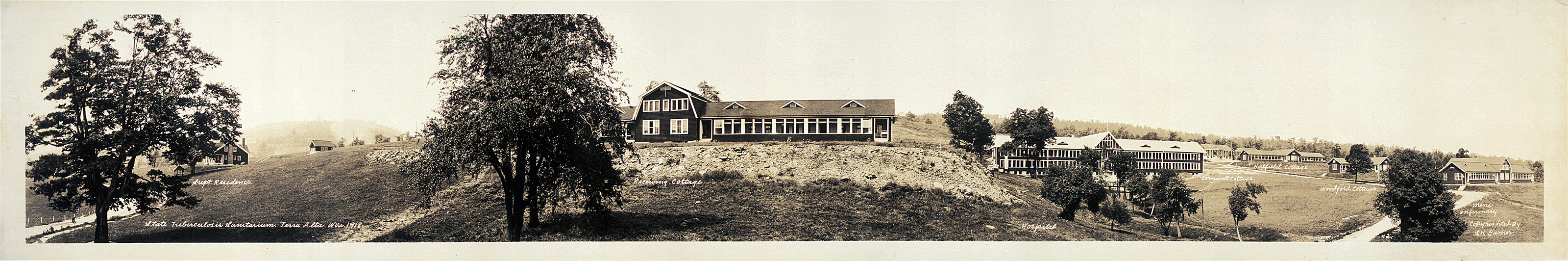 Tuberc SanitarTerra Alta, West Virginia, 1918 — historic image